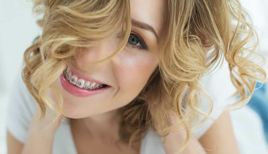 Braces Treatment